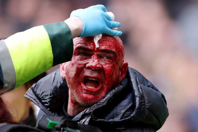 A spectator is tended to by paramedics at the Hawthorns