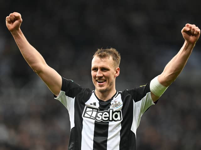 Dan Burn is a doubt for Newcastle's huge Premier League clash with Manchester City.