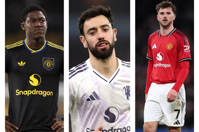 Latest Man United injury news ahead of their trip to Burnley on Wednesday.