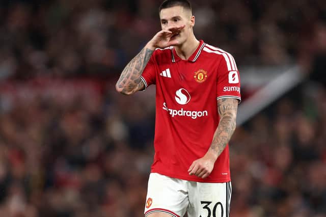 It's still uncertain whether Benjamin Šeško will be fit to face Tottenham Hotspur this weekend