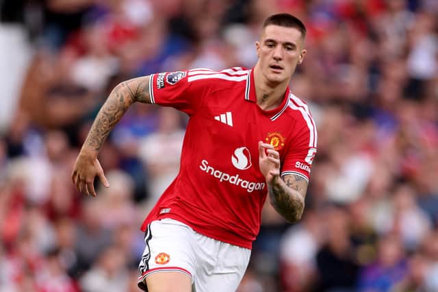 Benjamin Šeško's return date remains a mystery after a second shin injury
